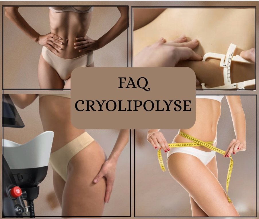 Cryolipolyse veyrier du lac