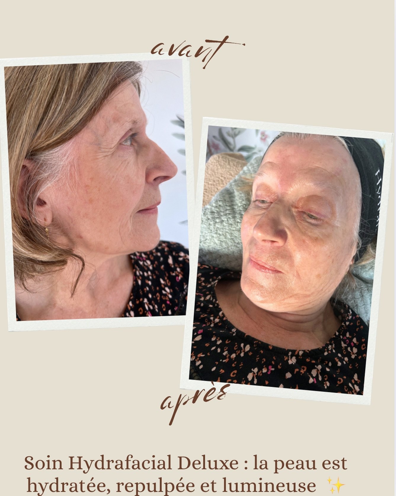 soin hydrafacial sevrier